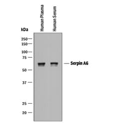 Human Serpin A6 Antibody, R D Systems 25&mu;g; Unlabeled:Antibodies, Polyclonal