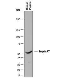 Human Serpin A7/TBG Antibody, R D Systems 25&mu;g; Unlabeled:Antibodies,