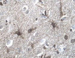 Human Serpin A8/Angiotensinogen Antibody, R D Systems 25&mu;g; Unlabeled:Antibodies,