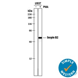 Human Serpin B2 Antibody, R D Systems 100&mu;L:Antibodies, Polyclonal