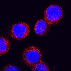 Human Serpin B2 Antibody, R D Systems:Antibodies:Primary Antibodies