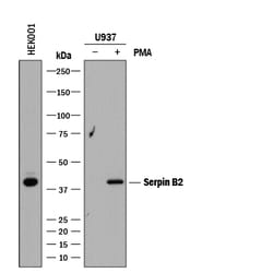 Human Serpin B2 Antibody, R D Systems:Antibodies:Primary Antibodies