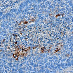 Human Serpin B3/SCCA1 Antibody, R D Systems 25&mu;g; Unlabeled:Antibodies,