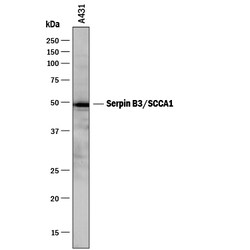Human Serpin B3/SCCA1 Antibody, R D Systems 25&mu;g; Unlabeled:Antibodies,