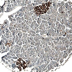 Human Serpin B8/Proteinase Inhibitor 8 Antibody, R D Systems 100ug; Unlabeled:Antibodies,