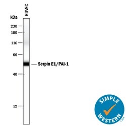 Human Serpin E1/PAI-1 Antibody, R D Systems 25&mu;g; Unlabeled:Anticuerpos