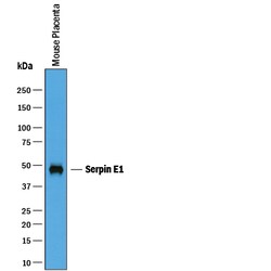 Mouse Serpin E1/PAI-1 Antibody, R D Systems 100&mu;g; Unlabeled:Antibodies,