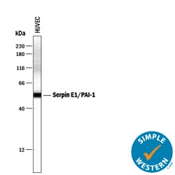 Human Serpin E1/PAI-1 Antibody, R D Systems 100&mu;g; Unlabeled:Antibodies,