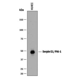 Human Serpin E1/PAI-1 Antibody, R D Systems 100&mu;g; Unlabeled:Antibodies,