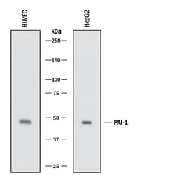Human Serpin E1/PAI-1 Antibody, R D Systems 100 &mu;g; Unconjugated:Antibodies,