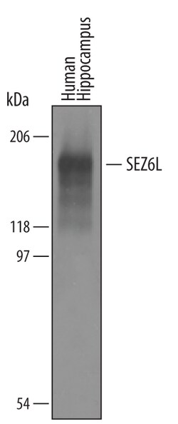 Human SEZ6L Antibody, R D Systems 25&mu;g; Unlabeled:Antibodies, Polyclonal