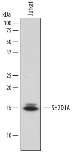 Human SH2D1A Antibody, R D Systems 25&mu;g; Unlabeled:Antibodies, Polyclonal