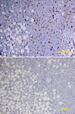 Human SHBG Biotinylated Antibody, R D Systems 50&mu;g; Biotin:Antibodies,