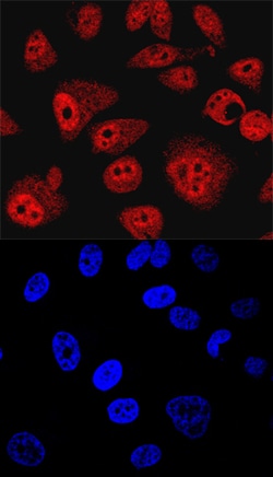 Human/Mouse/Rat SHIP2 Antibody, R D Systems 25 &mu;g | Buy Online | R&D Systems | Fisher Scientific