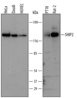 Human/Mouse/Rat SHIP2 Antibody, R D Systems 25 &mu;g | Buy Online | R&D Systems | Fisher Scientific