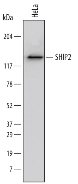 Human SHIP2 Antibody, R D Systems 25&mu;g; Unlabeled:Antibodies, Monoclonal