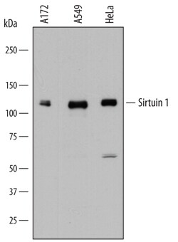 Human Sirtuin 1/SIRT1 Antibody, R D Systems 25&mu;g; Unlabeled:Antibodies,