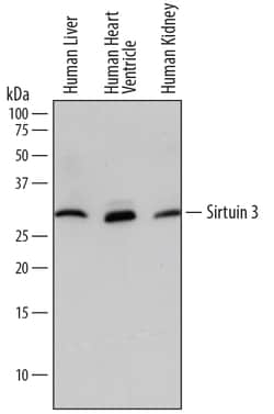 Human Sirtuin 3/SIRT3 Antibody, R D Systems 25&mu;g; Unlabeled:Antibodies,