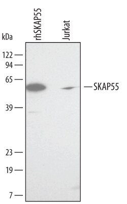 Human SKAP55 Antibody, R D Systems 25&mu;g; Unlabeled:Antibodies, Polyclonal
