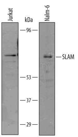 Human SLAM/CD150 Antibody, R D Systems 25&mu;g; Unlabeled:Antibodies, Polyclonal