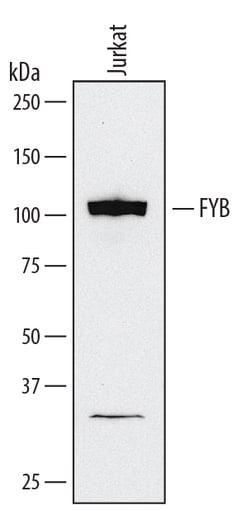 Human FYB/ADAP/SLAP130 Antibody, R D Systems 25&mu;g; Unlabeled:Antibodies,