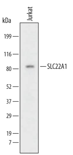 Human SLC22A1 Antibody, R D Systems 25&mu;g; Unlabeled:Antibodies, Monoclonal