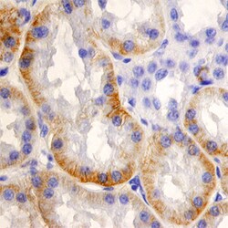 Human SLC22A2/OCT2 Antibody, R D Systems 100ug; Unlabeled:Antibodies, Monoclonal