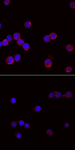 Human Phospho-SLP-76/LCP2 (Y145) Antibody, R D Systems 100ug; Unlabeled:Antibodies,