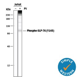 Human Phospho-SLP-76/LCP2 (Y145) Antibody, R D Systems 100ug; Unlabeled:Antibodies,