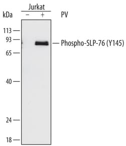 Human Phospho-SLP-76/LCP2 (Y145) Antibody, R D Systems 100ug; Unlabeled:Antibodies,