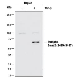 Human Phospho-Smad2/3 (S465/S467) Antibody, R D Systems 25&mu;g; Unlabeled:Antibodies,