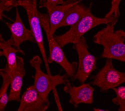 Human Smad3 Antibody, R D Systems 100ug; Unlabeled:Antibodies, Monoclonal