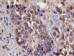 Human Smad3 Antibody, R D Systems 100ug; Unlabeled:Antibodies, Monoclonal