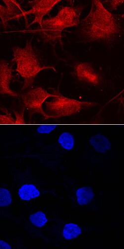 Human/Mouse Smad9 Antibody, R D Systems 25&mu;g; Unlabeled:Antibodies,