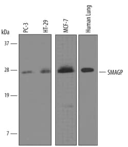 Human SMAGP Antibody, R D Systems 100&mu;g; Unlabeled:Antibodies, Polyclonal