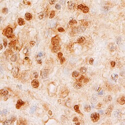 Human SMARCA5/SNF2H Antibody, R D Systems 25&mu;g; Unlabeled:Antibodies,