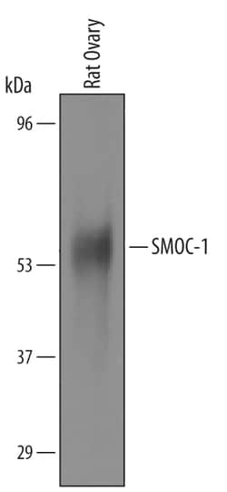 Mouse/Rat SMOC-1 Antibody, R D Systems 25&mu;g; Unlabeled:Antibodies, Polyclonal