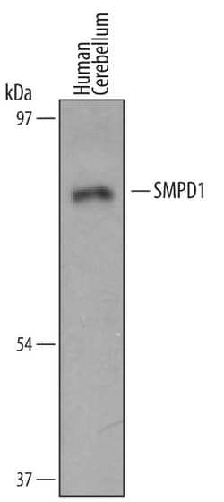 Human SMPD1 Antibody, R D Systems 100&mu;g; Unlabeled:Antibodies, Polyclonal