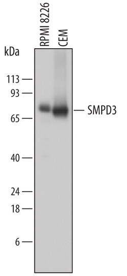 Human SMPD3 Antibody, R D Systems 25&mu;g; Unlabeled:Antibodies, Polyclonal