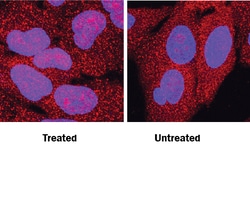 Human Snail Antibody, R D Systems 100&mu;g; Unlabeled:Antibodies, Polyclonal