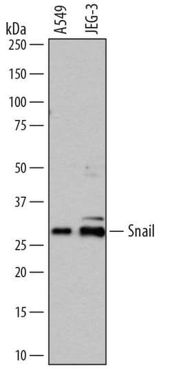 Human Snail Antibody, R D Systems 100&mu;g; Unlabeled:Antibodies, Polyclonal