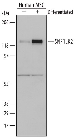 Human SNF1LK2 Antibody, R D Systems 100&mu;g; Unlabeled:Antibodies, Polyclonal