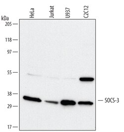 Human/Mouse SOCS-3 Antibody, R D Systems 100ug; Unlabeled:Antibodies, Monoclonal