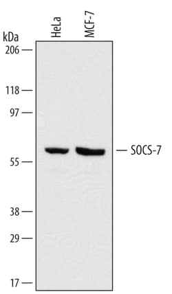 Human SOCS-7/Nck/NAP4 Antibody, R D Systems 25&mu;g; Unlabeled:Antibodies,