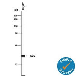 Human/Mouse SOD1/Cu-Zn SOD Antibody, R D Systems 50&mu;g; Unlabeled:Antibodies,
