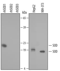 Human/Mouse SOD1/Cu-Zn SOD Antibody, R D Systems 50&mu;g; Unlabeled:Antibodies,