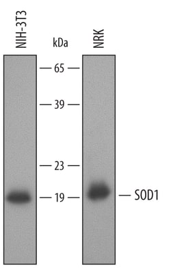 Mouse/Rat SOD1/Cu-Zn SOD Antibody, R D Systems 100&mu;g; Unlabeled:Antibodies,