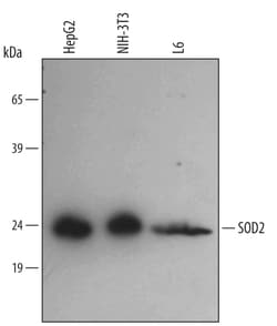 Human/Mouse/Rat SOD2/Mn-SOD Antibody, R D Systems 25&mu;g; Unlabeled:Antibodies,