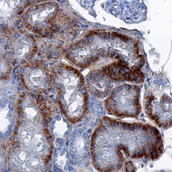 Human SOD3/EC-SOD Antibody, R D Systems 100&mu;g; Unlabeled:Antibodies,