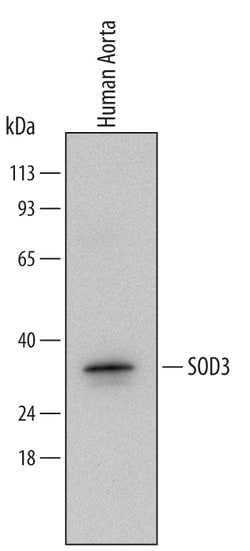 Human SOD3/EC-SOD Antibody, R D Systems 100&mu;g; Unlabeled:Antibodies,